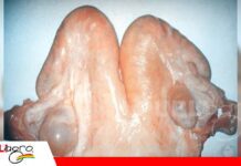 El control reproductivo permite prevenir pérdidas por quistes ováricos Importancia de detectar los quistes ováricos/ Foto: Internet